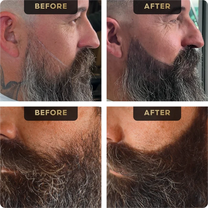 Baldr's Beard Pen, image 2. The Beard Struggle