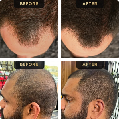 Hair Concealer, image 2. The Beard Struggle