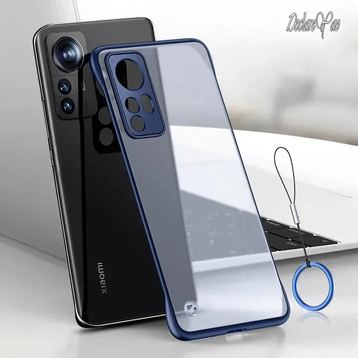 Xiaomi 13 / Blue Lanyard Ring / China|Confirm Case Model