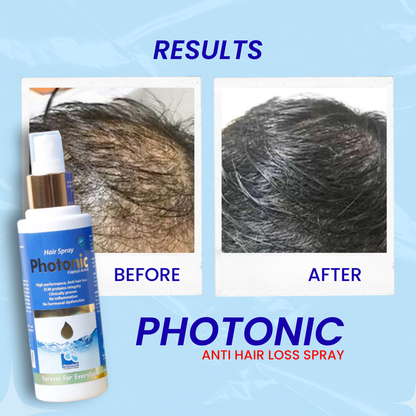 Photonic Hair Spray Anti Hair Loss
