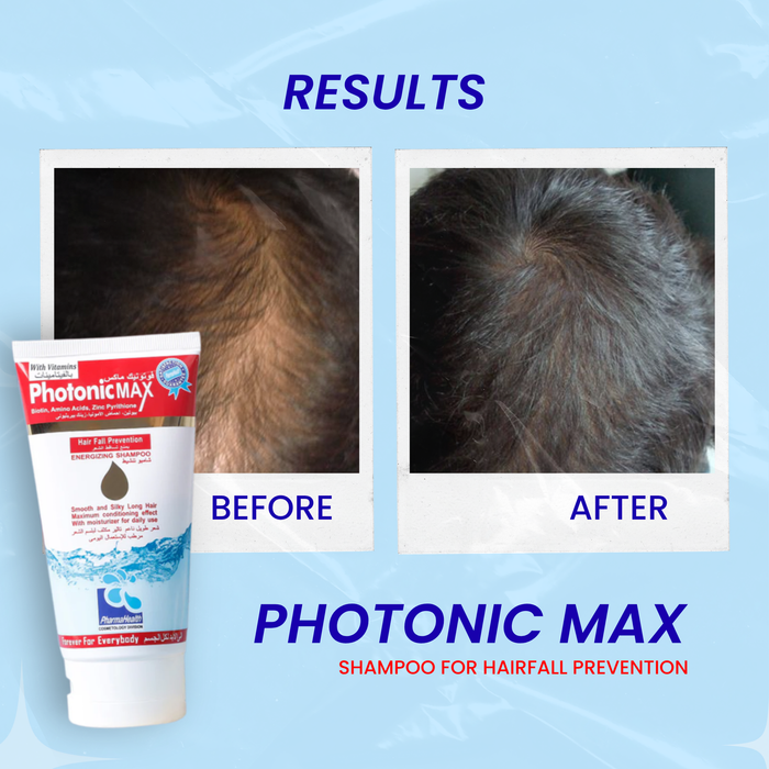Photonic MAX Shampoo for Hairfall Prevention